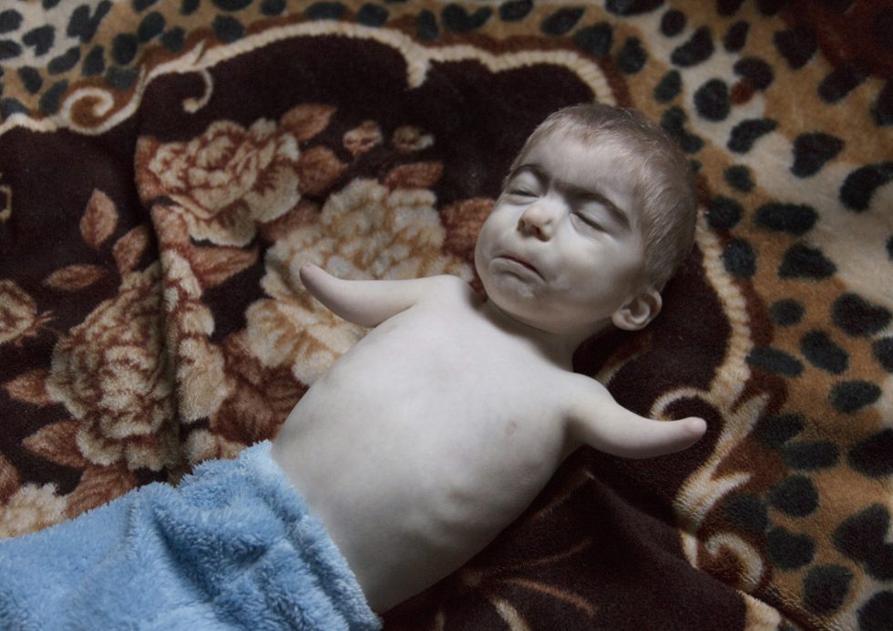 Life after Chernobyl